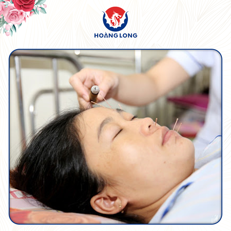 Trị liệt dây thần kinh ngoại biên số 7